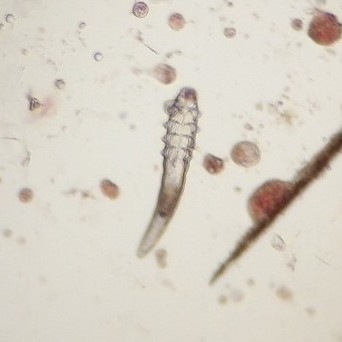 Microscopic Image of a Parasite